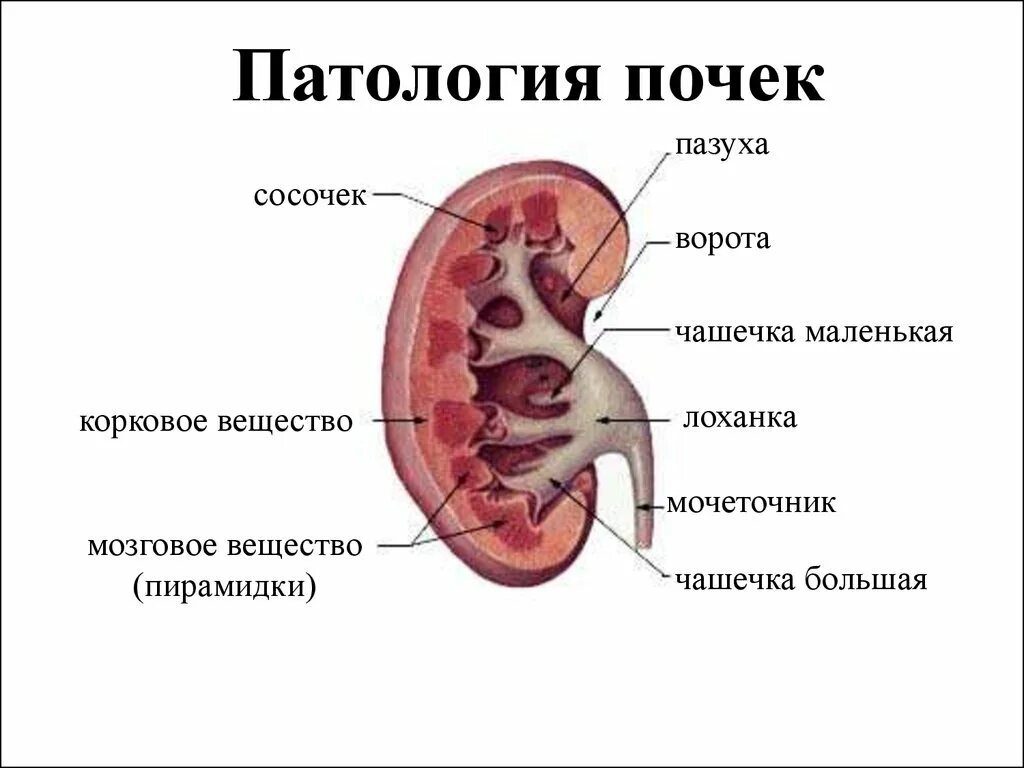 Лоханка образована. Строение почки почечная лоханка. Почечечная пазуха строение. Строение почки почечный синус. Внутренне строение почки анатомия.