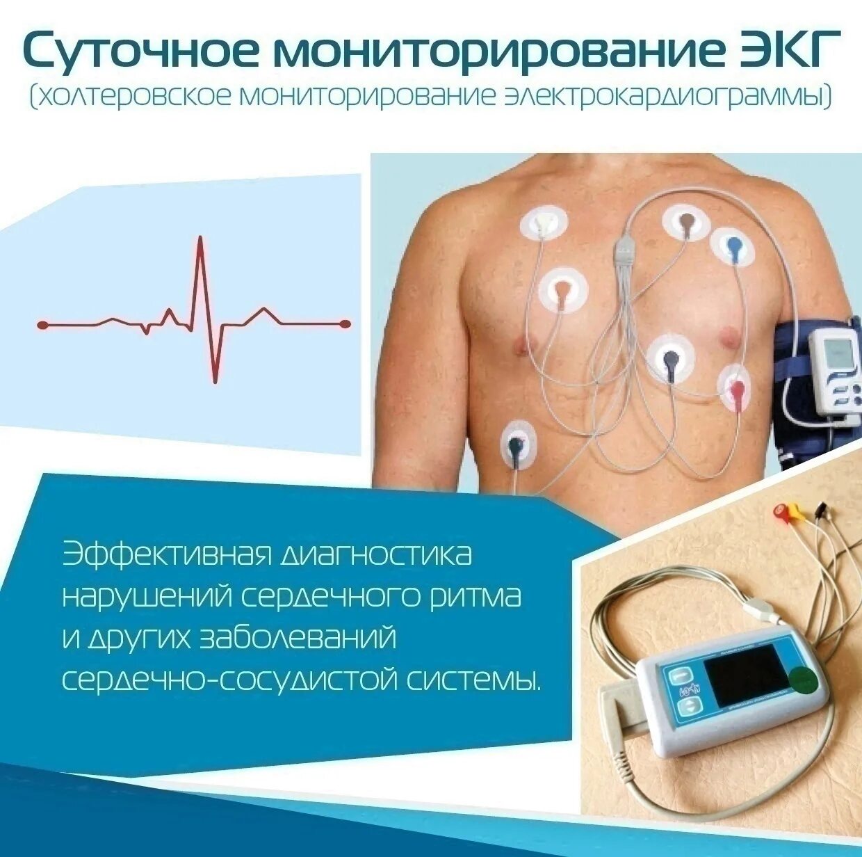Хм экг сердца что. Хм экг сердца что. Холтер мониторирование экг. Холтер мониторинг экг. Суточный холтер экг.