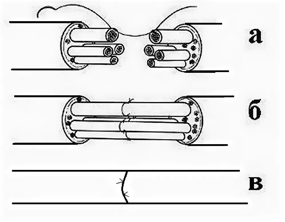 Методика сшивания нерва. Методика сшивания нерва схема. Схематически изобразите методику сшивания нерва.. Сшивание нерва латынь