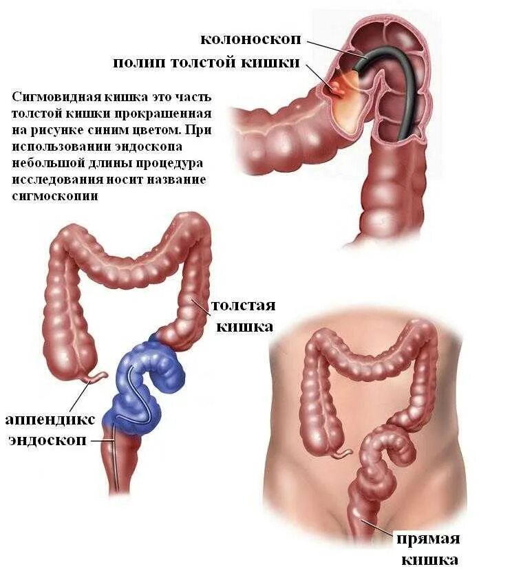 Можно ли есть кишки. Исследование толстой кишки колоноскопия. Колоноскопия это обследования Толстого кишечника. Строение кишечника колоноскопия. Колоноскопия кишечника сигмовидная кишка.