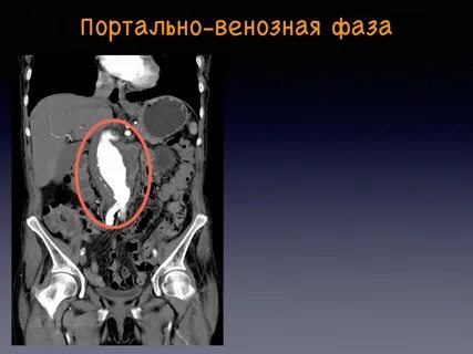 Кт с контрастом адреса
