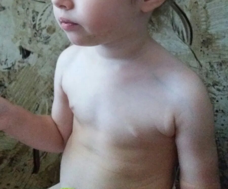 Телархе это