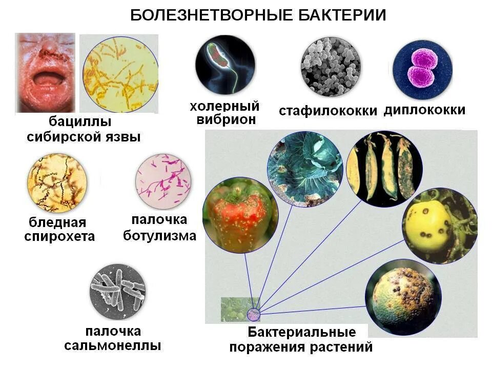 Болезнетворные бактерии биология. Болезнетворные бактерии. Болезнетворные бактерии патогенные. Болезнетворные бактерии виды. Болезнетворные бактерии 5 класс.