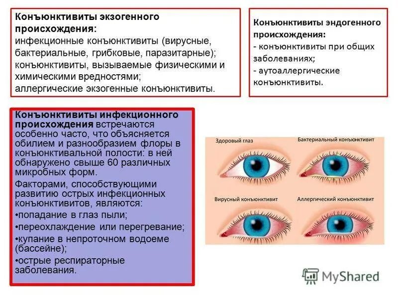 Конъюнктивит какие симптомы