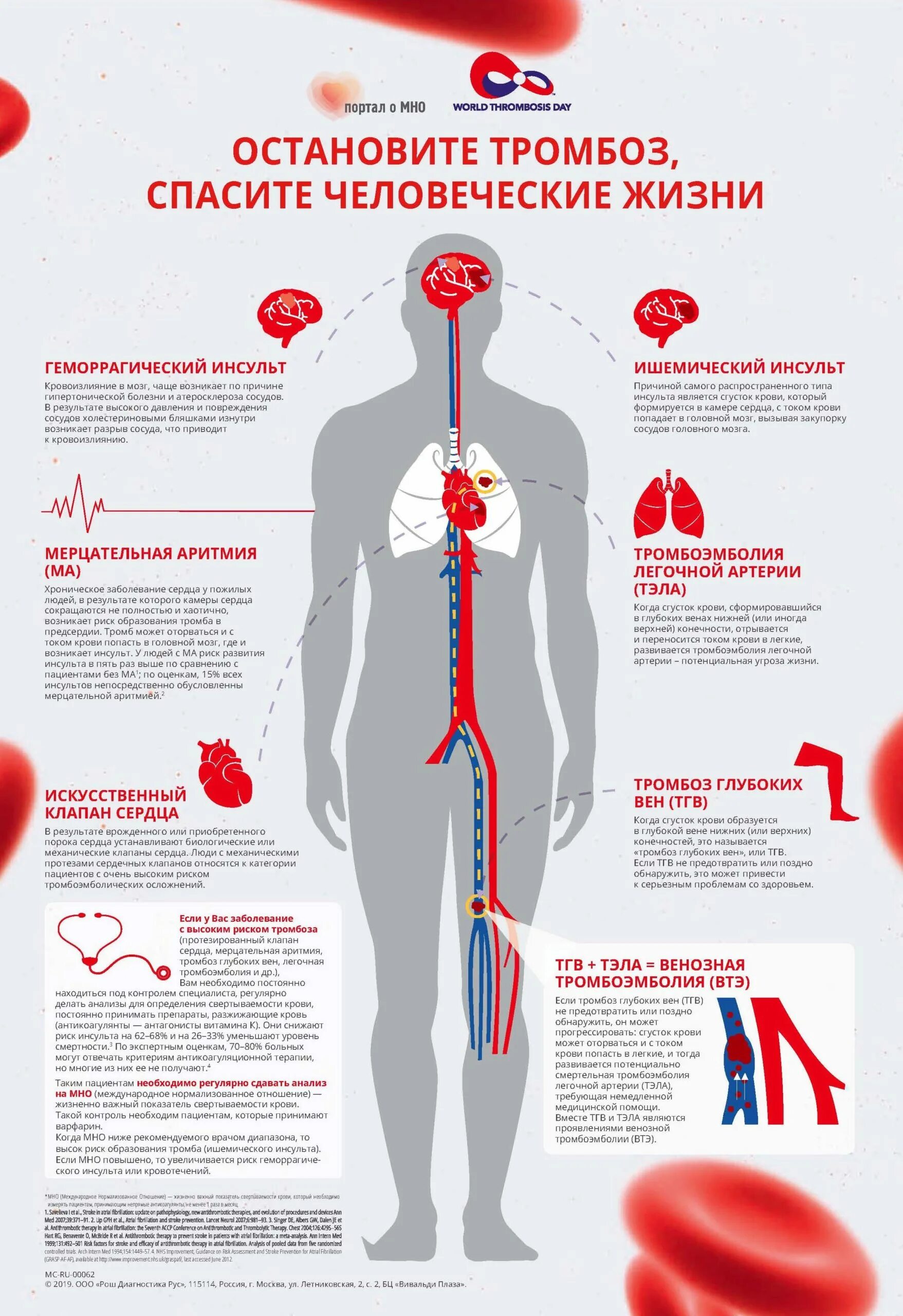 Профилактика тромбоза. Всемирный день тромбоза. Всемирный день борьбы с тромбозом. Листовка профилактика тромбоза. Лечение профилактика тромбоза