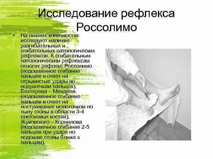 Нервные болезни россолимо
