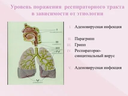 Парагрипп аденовирусная инфекция