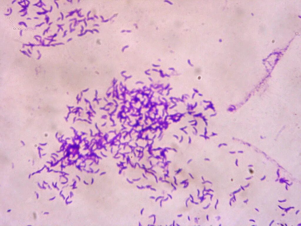хеликобактер пилори микроскопия. хеликобактер пилори окраска по граму. хеликобактер пилори микроскопия. хеликобактер мазок. хеликобактер пилори по граму.