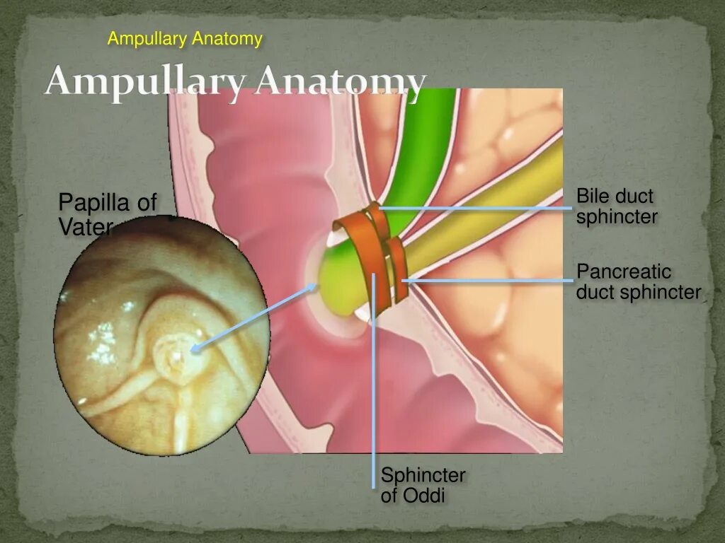 Анатомия сфинктера Одди. Сфинктер Одди расположение. Анатомические элементы сфинктера Одди.