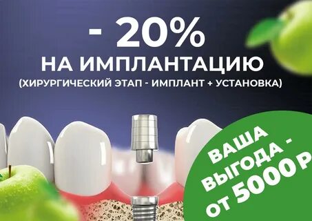 Имплант отзывы екатеринбург