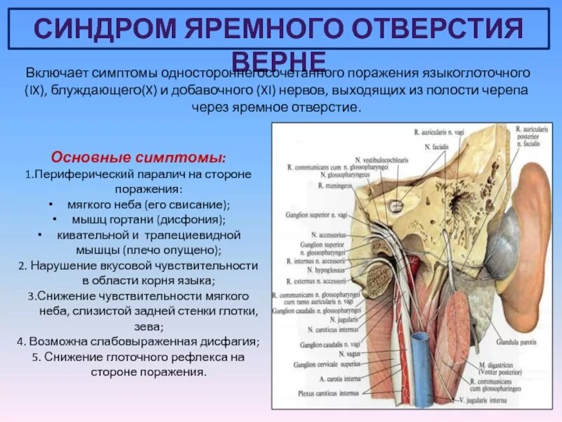 Поражение блуждающего нерва. Шилососцевидное отверстие нерв. Синдром яремного отверстия. Через яремное отверстие.. Яремное отверстие нервы.