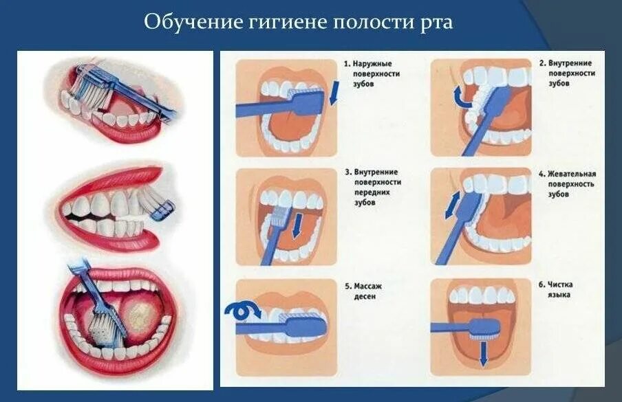 Проводить гигиену полости рта необходимо. Профилактика кариеса воспалительных заболеваний пародонта. Алгоритм чистить зубы для детей. Как правильно чистить зубы для детей в детском саду. Схема чистки зубов электрической зубной щеткой.