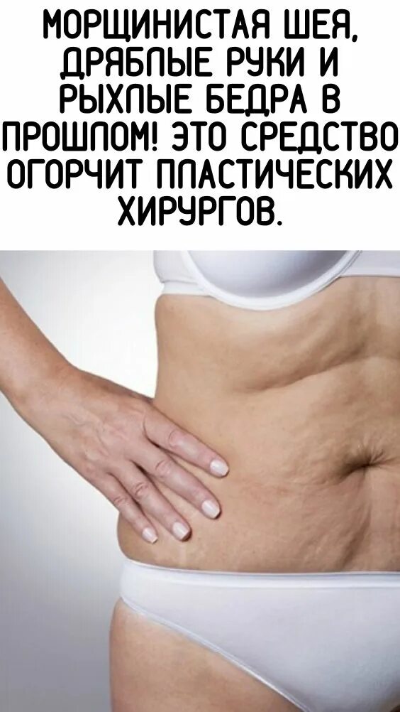 Как подтянуть кожу тела. Как подтянуть кожу тела