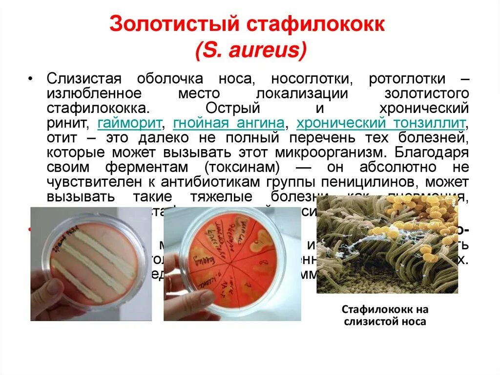 Золотистый стафилокоо. Бактерия золотистый стафилококк. Бактерия золотистый стафилококк доклад. Сообщение о бактерии стафилококки. Staphylococcus aureus 4