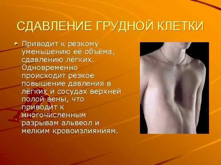 Болит в грудине посередине. Заболевания которые приводят к плевриту. Основные ранние симптомы туберкулеза легких. Сдавление грудной клетки. Причины травм грудной клетки.