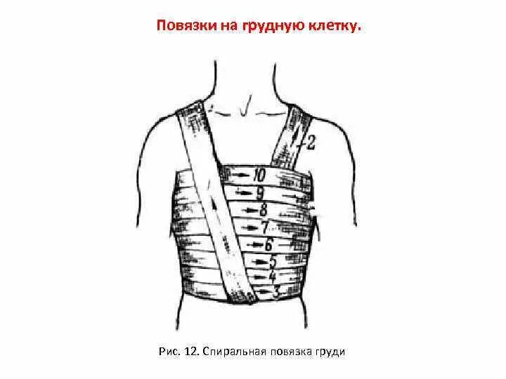 Наложение повязки на грудную клетку. Наложение повязки на грудную клетку