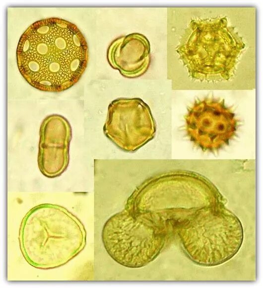1 образование пыльцы в пыльцевых. Пыльца микроскопия палинология. Яйца гельминтовпыльца микроскопич. Микроскопия кала яйца гельминтов. Пыльца микроскопия атлас.