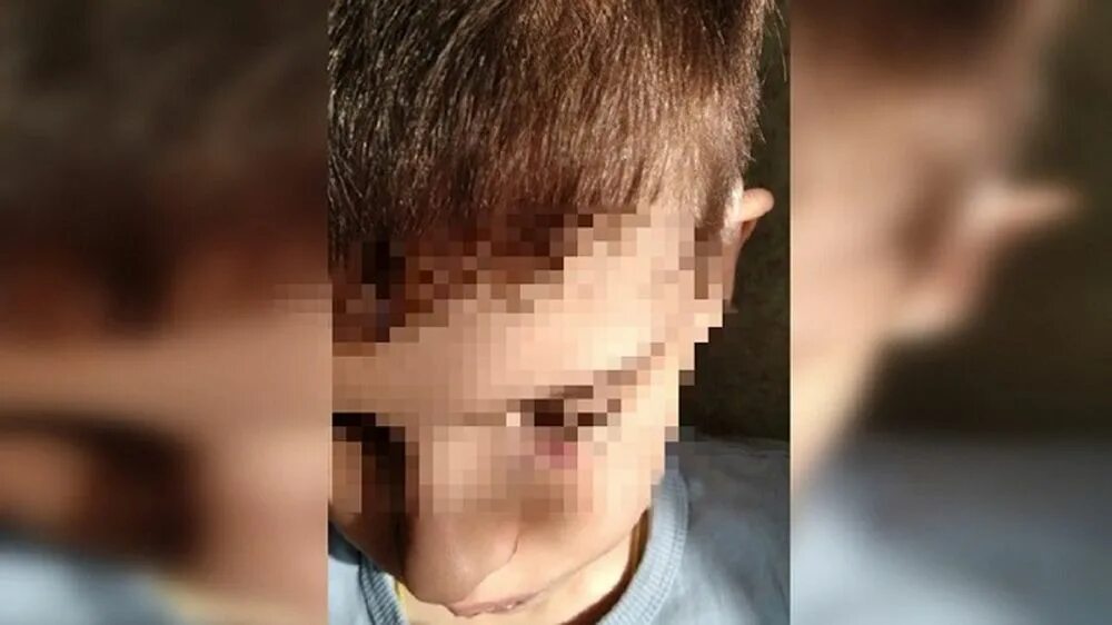 Мальчика избили в школе