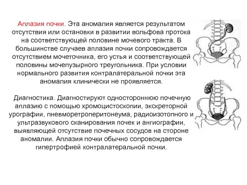 Лечение аплазии