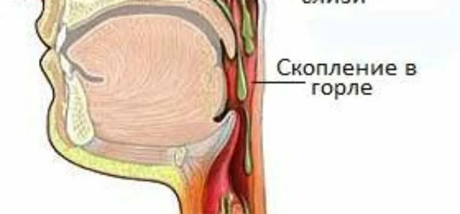 В носоглотке скапливается.