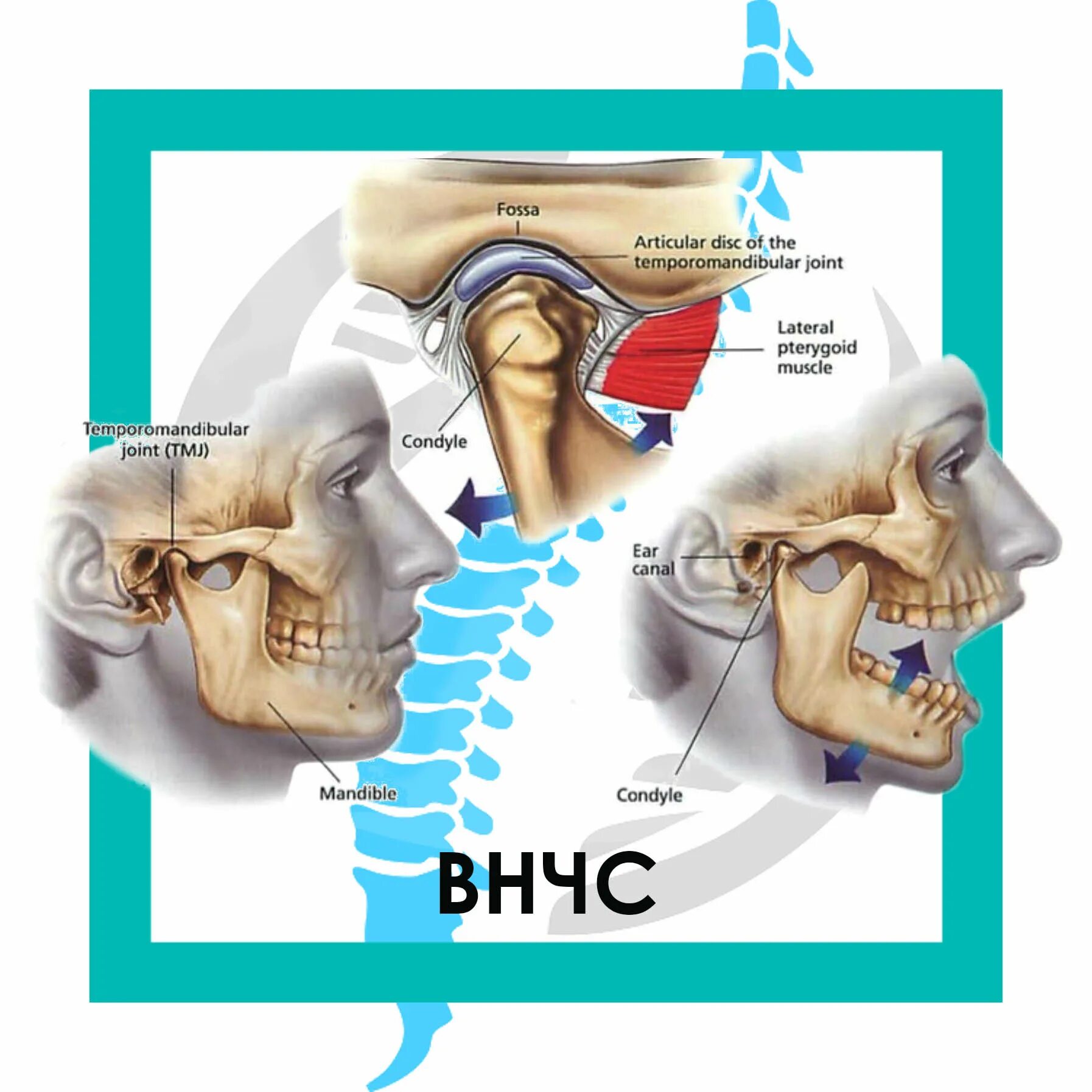 Заболевания внчс клиника. Воспаление нижнечелюстного сустава сустава. Артрит челюстного сустава симптомы и лечение. Артрит челюстного сустава симптомы и лечение. Артрит височно-нижнечелюстного сустава.