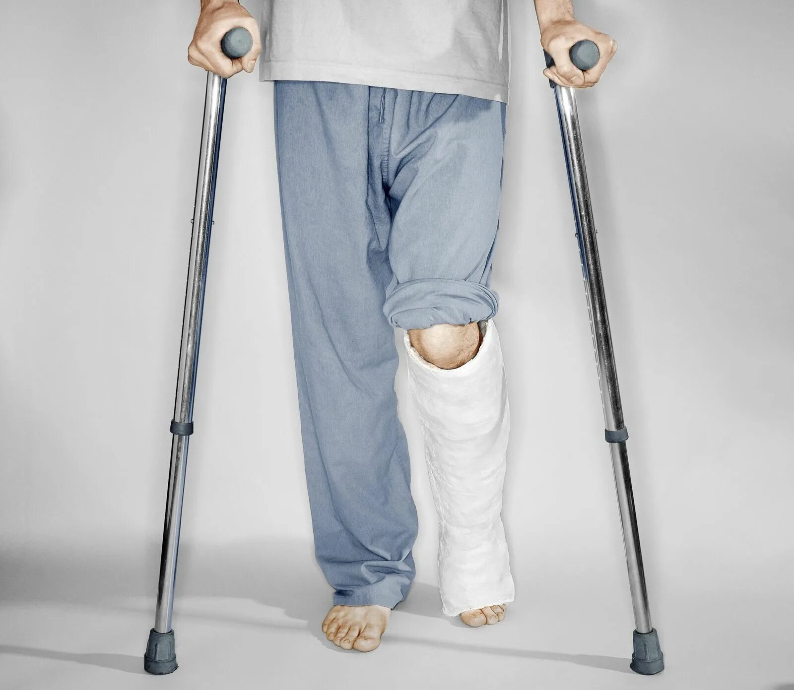 Сколько нужно ходить на костылях после эндопротезирования. Ходьба на костылях. Костыли при переломе ноги. Трость для ноги. Палка для ходьбы при переломе.