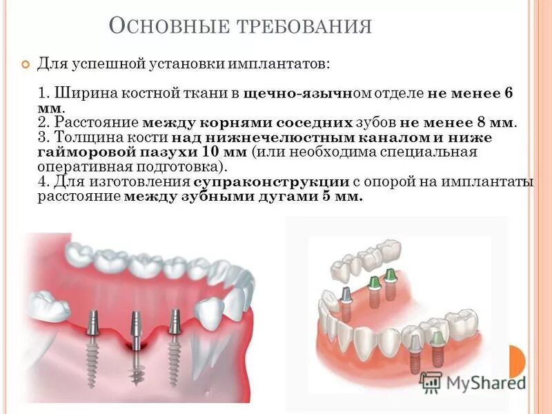 Какое расстояние между зубами. Ширина импланта зуба. Расстояние между имплантом и зубом. Расстояние между имплантами зубов. Антибиотики после имплантации.