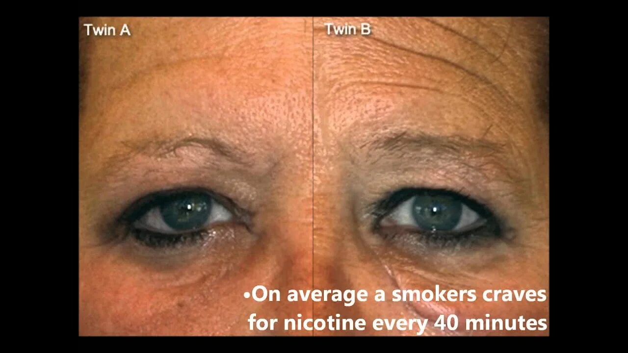 Курящие до и после. Кожа курящих и некурящих.