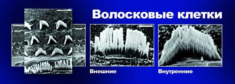 Волосковая клетка внутреннего уха. Наружные волосковые клетки уха. строение уха волосковые клетки. волосковые клетки внутреннего уха. внутреннее ухо волосковые клетки.
