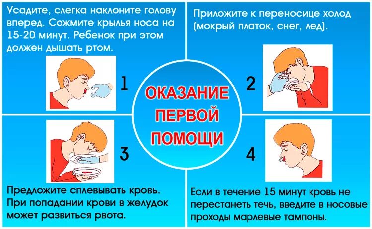 Головокружение носовое кровотечение. У ребенка идет кровь из носа. Идёт кровь из носа что делать. Какостанововить носовое кровотечение.