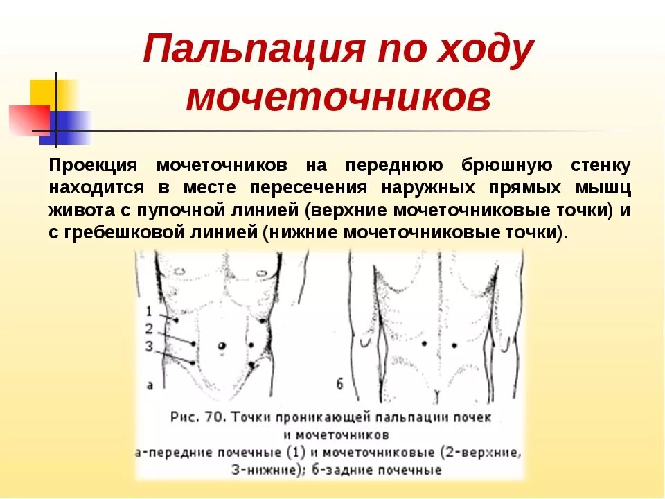 Больно живот при пальпации. Проекция почек на переднюю брюшную стенку. проекция мочеточника на переднюю брюшную стенку. пальпация проекции мочеточников.. точки пальпации мочеточниковых точек.