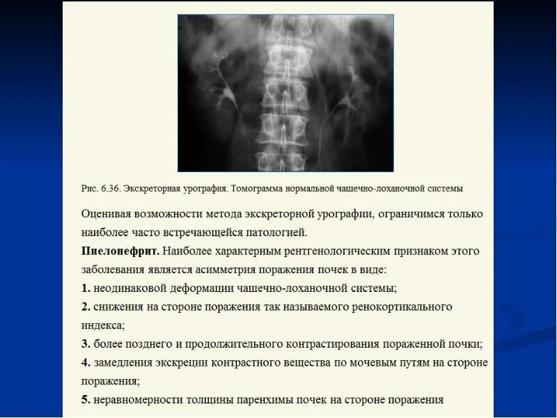Подготовка к экскреторной урографии алгоритм