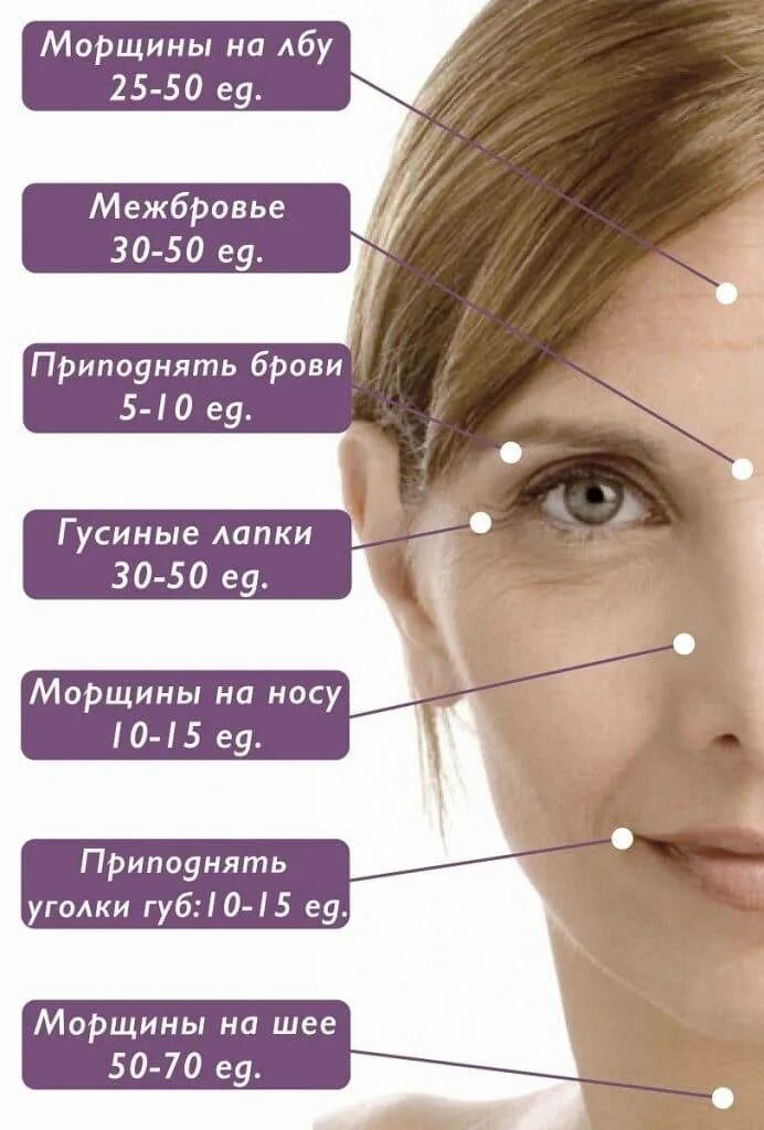 Куда колят ботокс. Точки введения диспорта схема. точки для введения ботокса в межбровье. мимические морщины. схема введения ботокса.