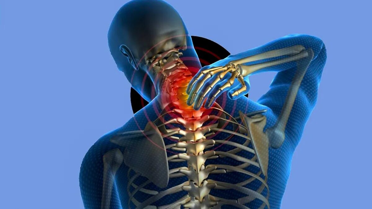 Хандроз или хондроз симптомы. Протрузия шейного отдела позвоночника. Хондроз с4-с5. Протрузия шейного отдела позвоночника с3 - с5. Хондроз шейного отдела с4-с6.