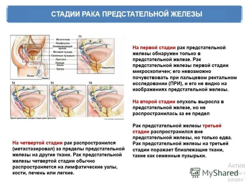 Диета при простатите и аденоме простаты. Факторы риска аденомы предстательной железы. Питание предстательной железы. Питание при аденоме предстательной железы и простатите. Питание предстательной железы.