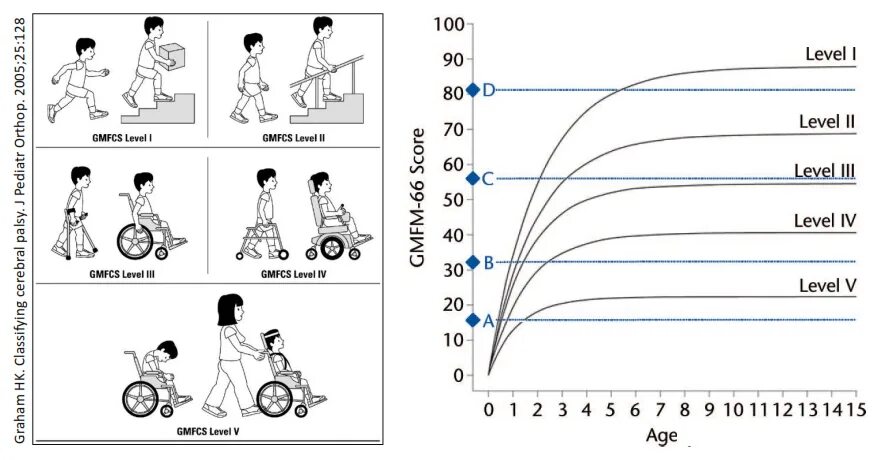 Шкалы дцп. ДЦП шкала GMFCS. Классификация больших моторных функций GMFCS. GMFCS шкала при ДЦП для детей до 3. Уровни GMFCS ДЦП.