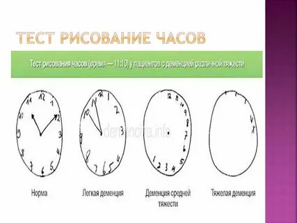 Тесты на деменцию в картинках