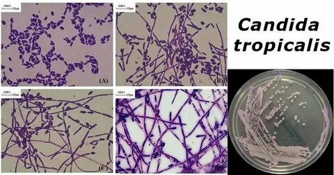 Candida dubliniensis