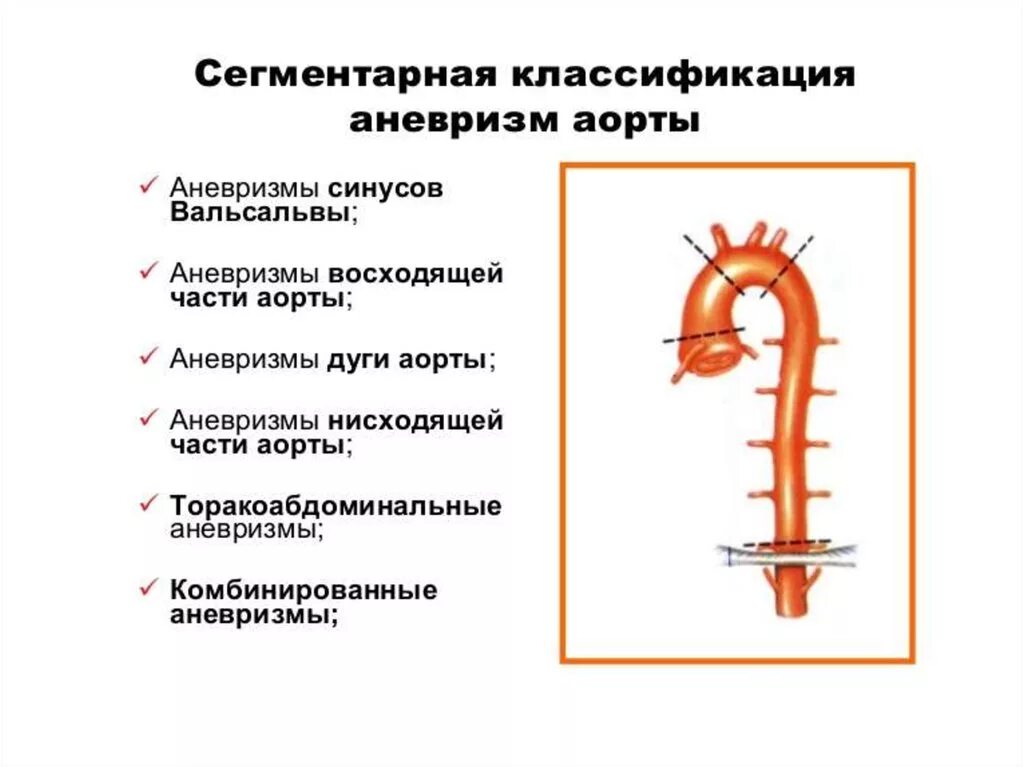 Классификация аневризм восходящего отдела аорты. Расширение восходящего отдела аорты классификация. Классификация аневризмы брюшного отдела аорты. Аневризмы восходящего отдела аорты классификация. Аневризма восходящей аорты операция