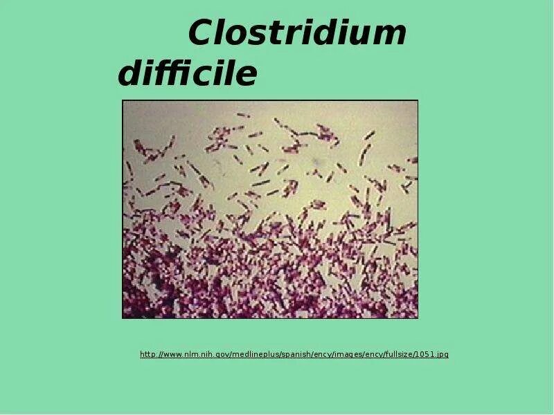 Clostridium difficile что это. Clostridium difficile микробиология. Клостридии диффициле морфология. Клостридии диффициле мазок.