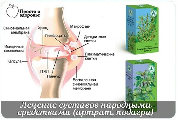 Домашнее средство для суставов. Домашнее средство для суставоо. Артрит коленного лечение народные средства. Артрит коленного лечение народные средства. Питание при артрите суставов.