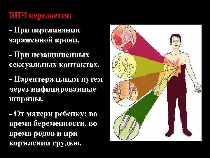 Вич при однократном. ВИЧ передается. ВИЧ передается через кровь. Через что передается СПИД. ВИЧ инфекция передается.