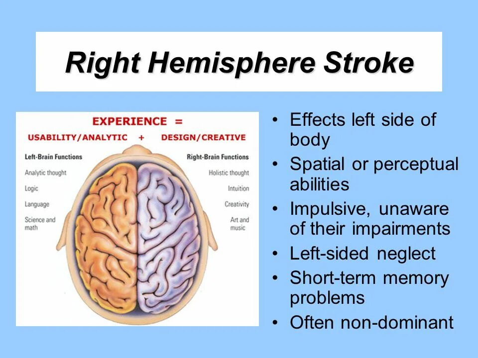 Left sided 2. From the right side of the heart. The left-sided limit of the function. Lbbb. Left bundle branch block ecg.