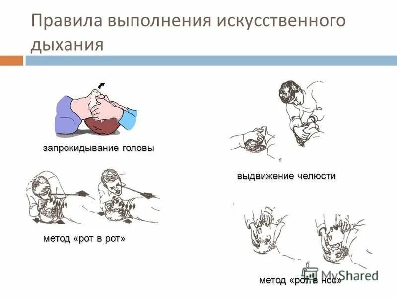 Правила выполнения искусственного