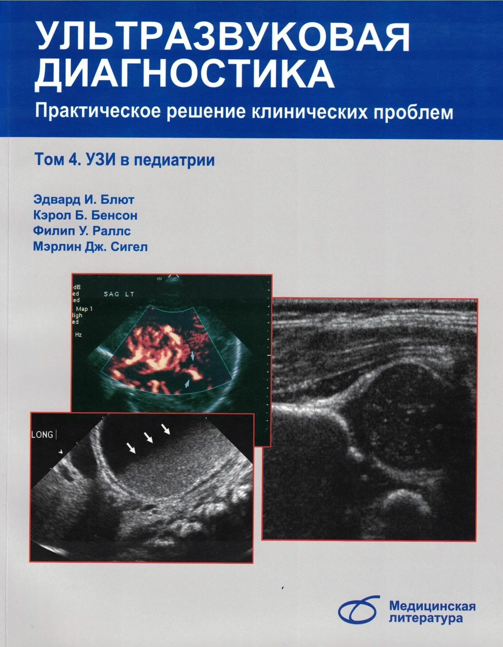 Диагностика т в матолина. Книги по узи. ультрозвуковая диагностика. ультразвуковая диагностика (узи).