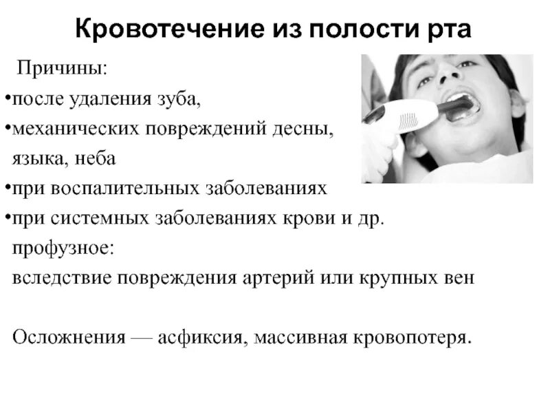 Кровотечение из полости рта. Кровотечение после удаления зуба. Кровотечение изо рта причины. Кровотечение из полости рта причины. Во рту в домашних условиях рецепт