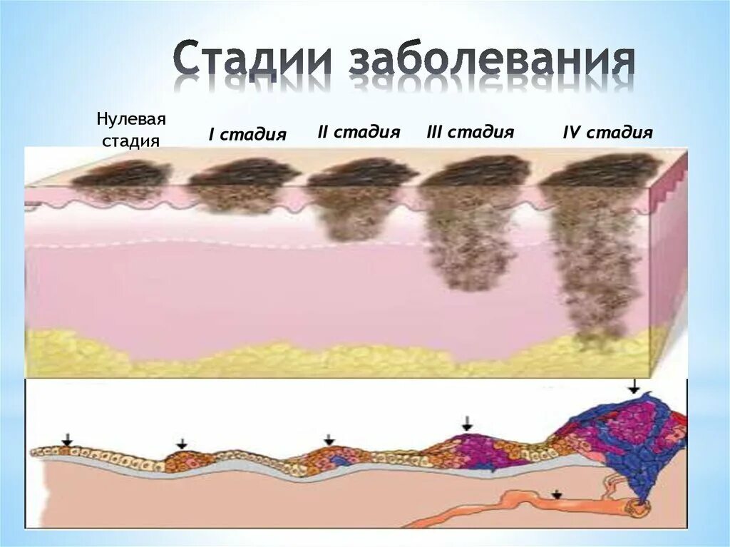 Как быстро развивается