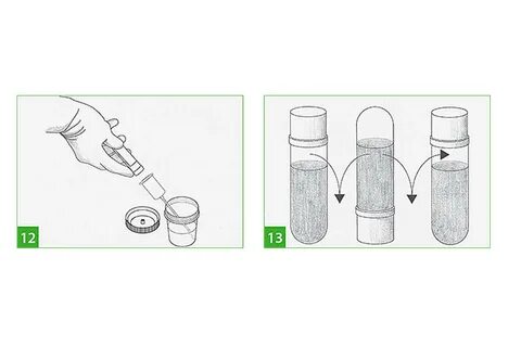 Сбор мочи беременным FotoStock74.ru