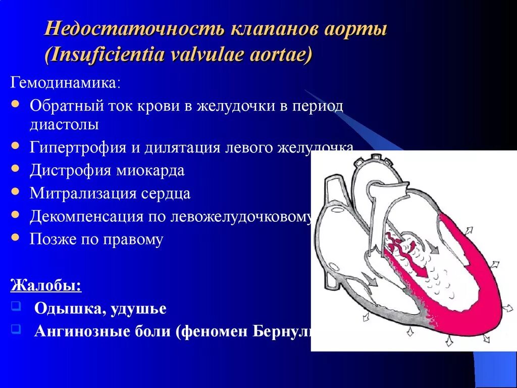 Порок аортального клапана сердца. Аортальная недостаточность гемодинамика схема. Недостаточность клапана аорты гемодинамика. Недостаточность полулунного клапана аорты. Гемодинамика пациента