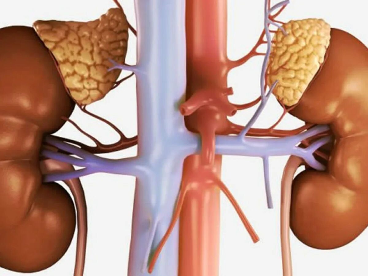 Аденома надпочечника у мужчин что это. Альдостерома надпочечника. Гиперплазия надпочечников фото. Аденома левого надпочечника. Аденома надпочечника у женщин.